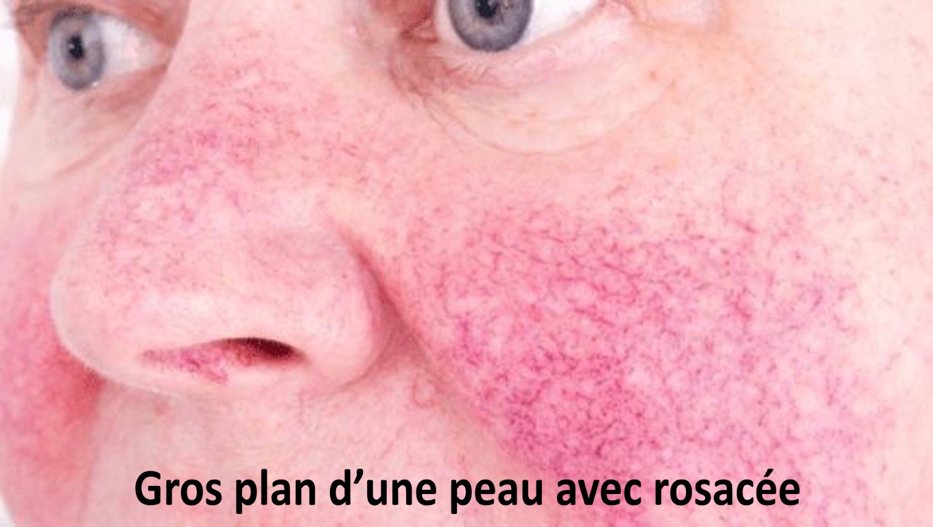 Quels sont les 12 effets secondaires les plus courants de l’amlodipine et les habitudes quotidiennes qui peuvent faire la différence ?