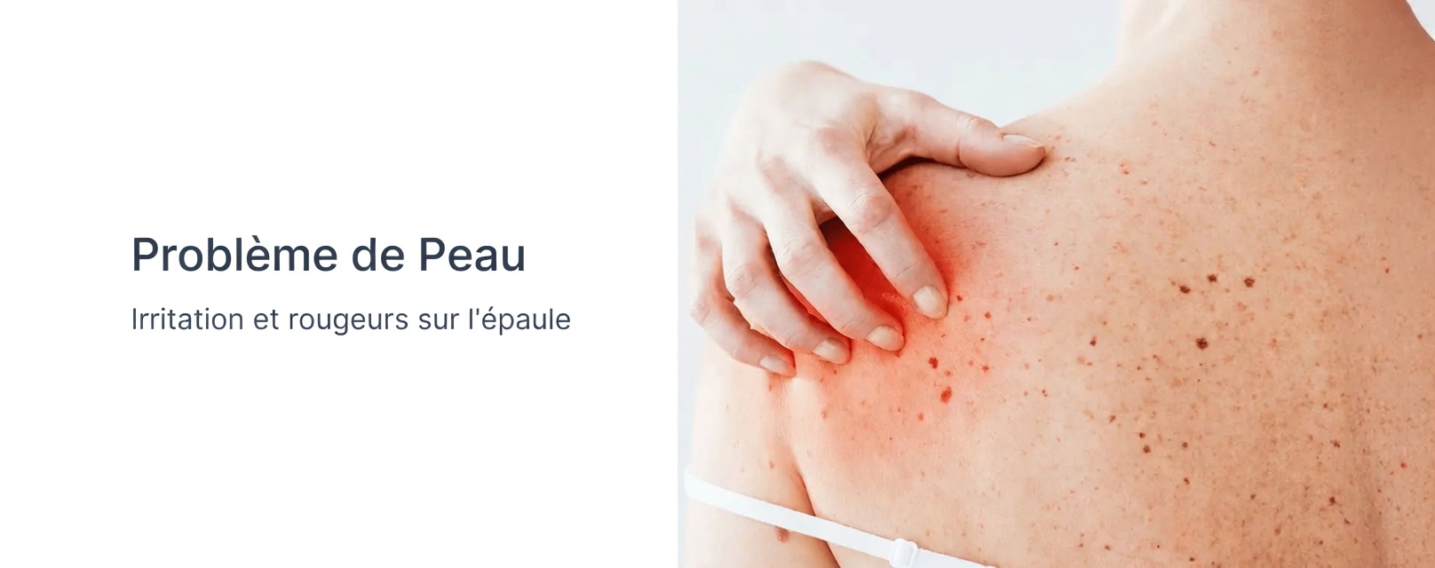 10 signes avant-coureurs du cancer du pancréas qui vous surprendront