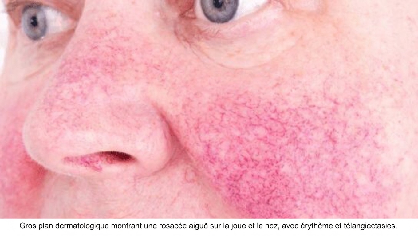 Quels sont les 12 effets secondaires les plus courants de l’amlodipine et les habitudes quotidiennes qui peuvent faire la différence ?