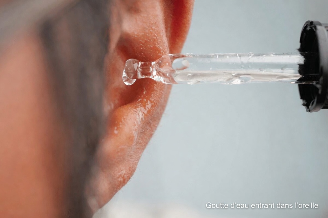 Mettre 4 gouttes d’huile d’olive dans votre oreille : guide simple pour les soins quotidiens des oreilles