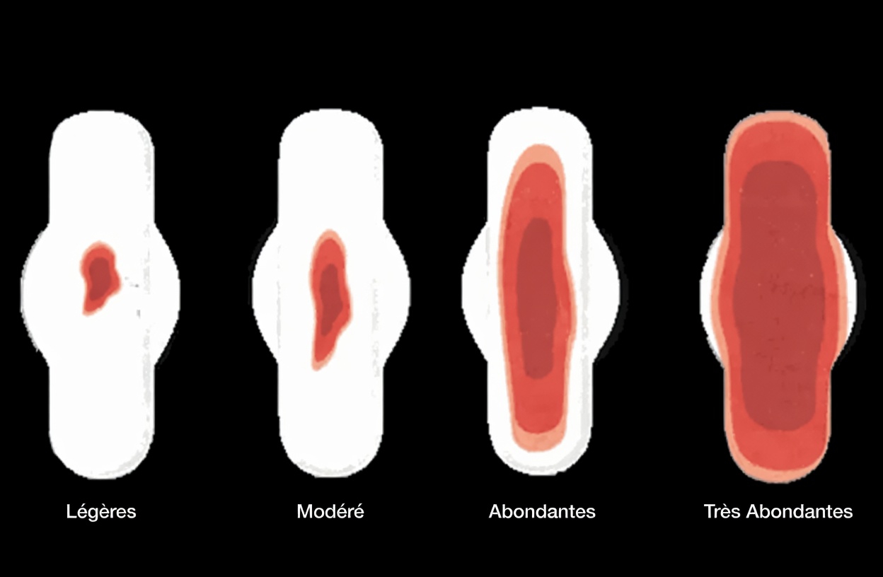 9 signes avant-coureurs précoces du cancer du col de l’utérus que la plupart des femmes ignorent et comment les reconnaître