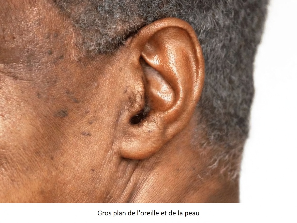 Pourquoi les poils des oreilles deviennent-ils plus abondants avec l’âge – et que pouvez-vous y faire ?