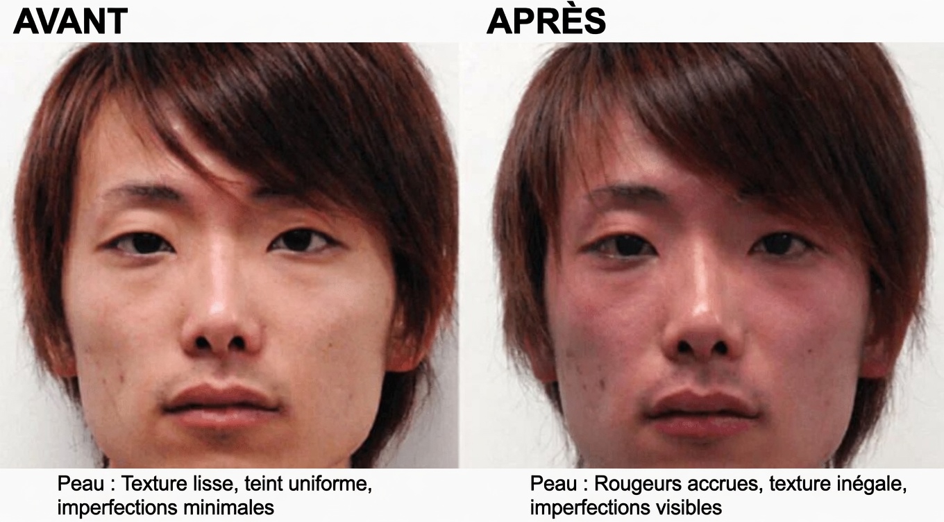 12 effets secondaires de l’amlodipine que vous devez connaître – Guide complet pour les utilisateurs