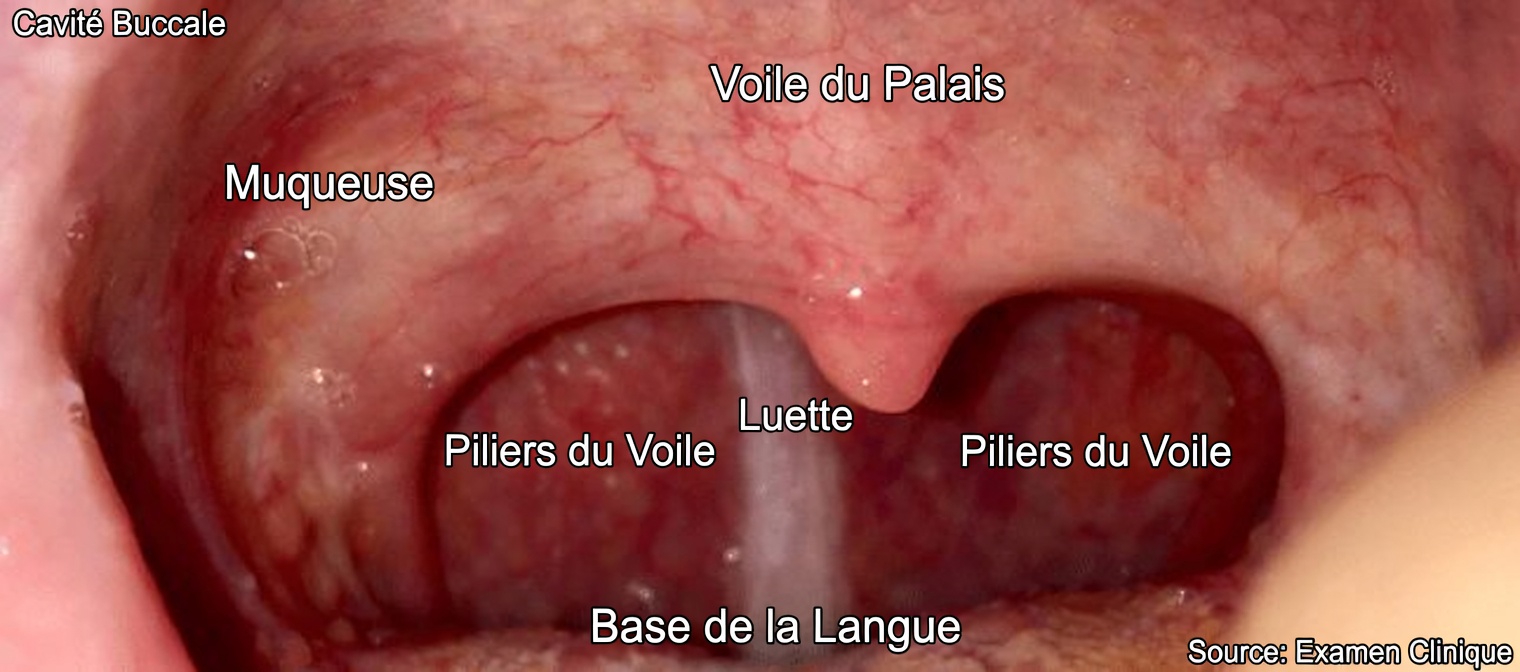 Pourquoi avez-vous constamment du mucus dans la gorge ? L’habitude cachée qui l’aggrave sans que vous le sachiez