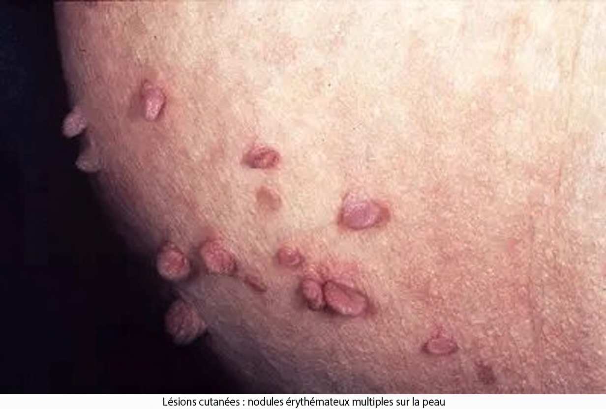 11 signes du diabète que peu de gens connaissent et qui pourraient se cacher à la vue de tous