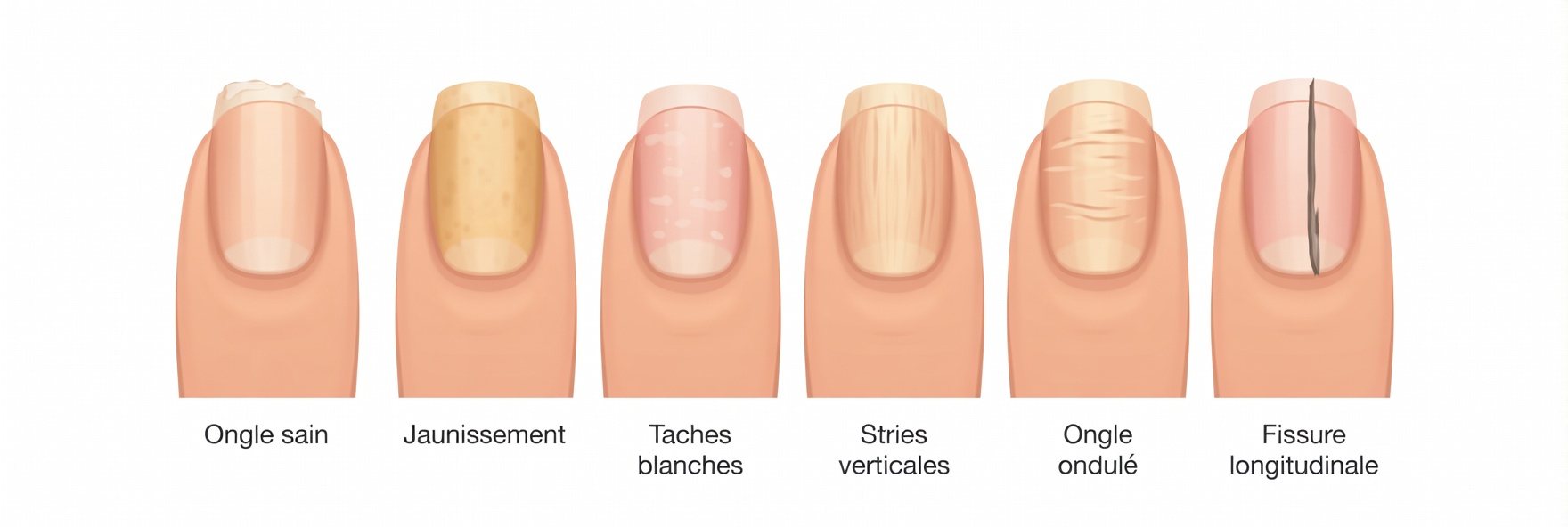 Pourquoi vos ongles peuvent révéler des indices sur ce qui se passe à l’intérieur