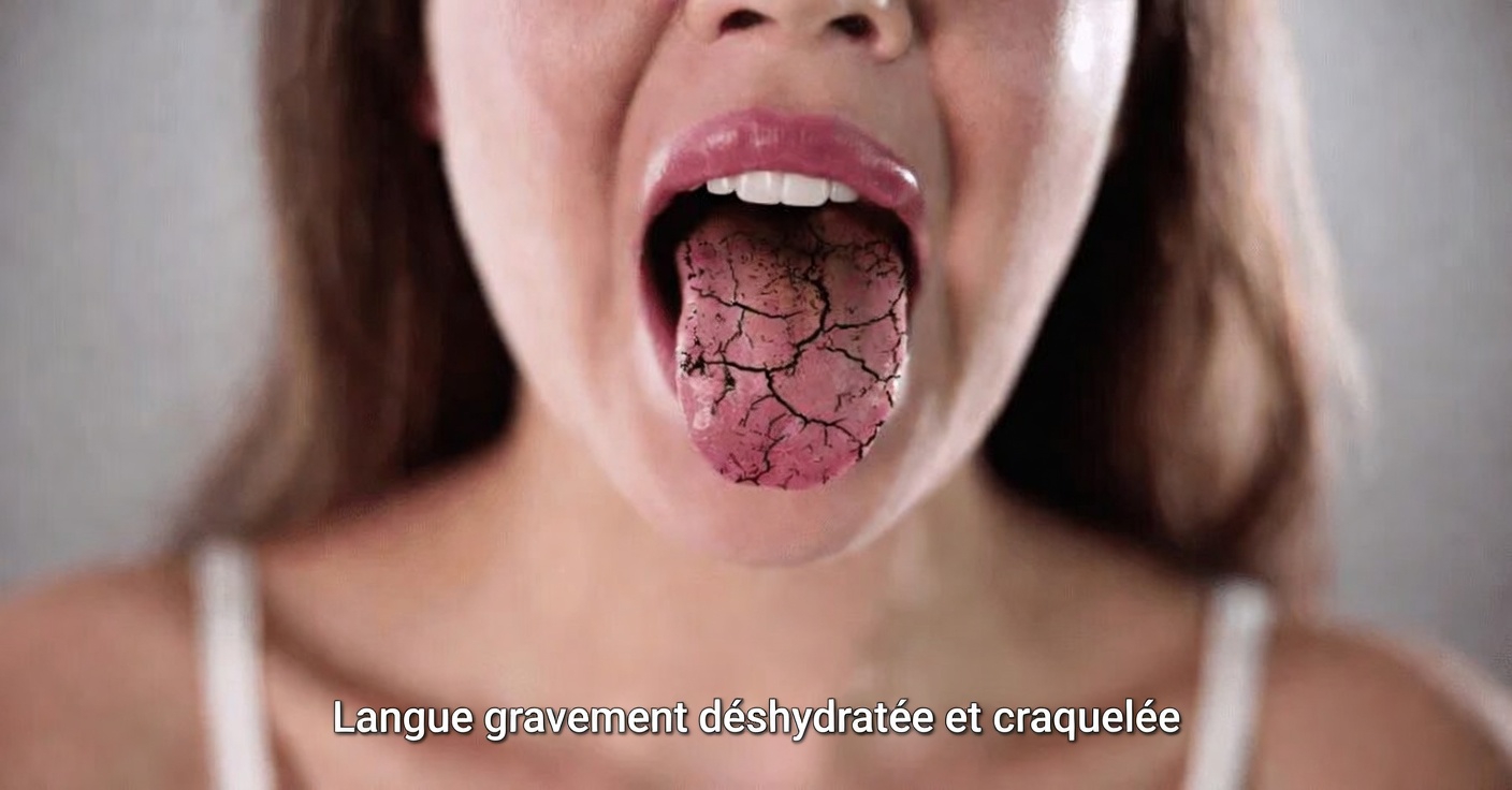 Découvrez 7 signes étranges que vos reins pourraient discrètement envoyer pour demander de l’aide et que la plupart des gens négligent