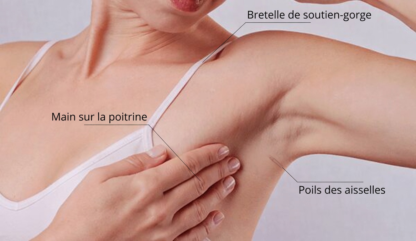 10 signes avant-coureurs du cancer du sein que chaque femme devrait connaître et ne jamais ignorer