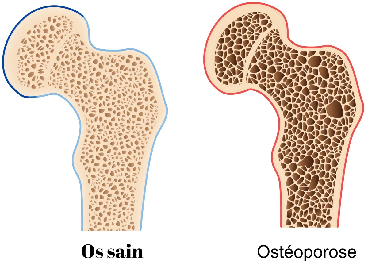 Prenez-vous du Prilosec tous les jours ? Voici 5 faits essentiels sur l’utilisation à long terme que tout le monde doit connaître