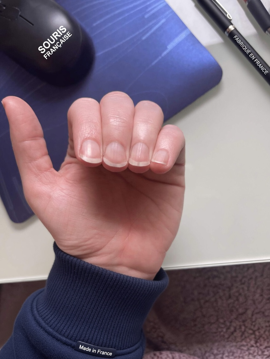 Pourquoi des lignes apparaissent-elles sur vos ongles ? Ce qu’elles pourraient révéler sur votre santé