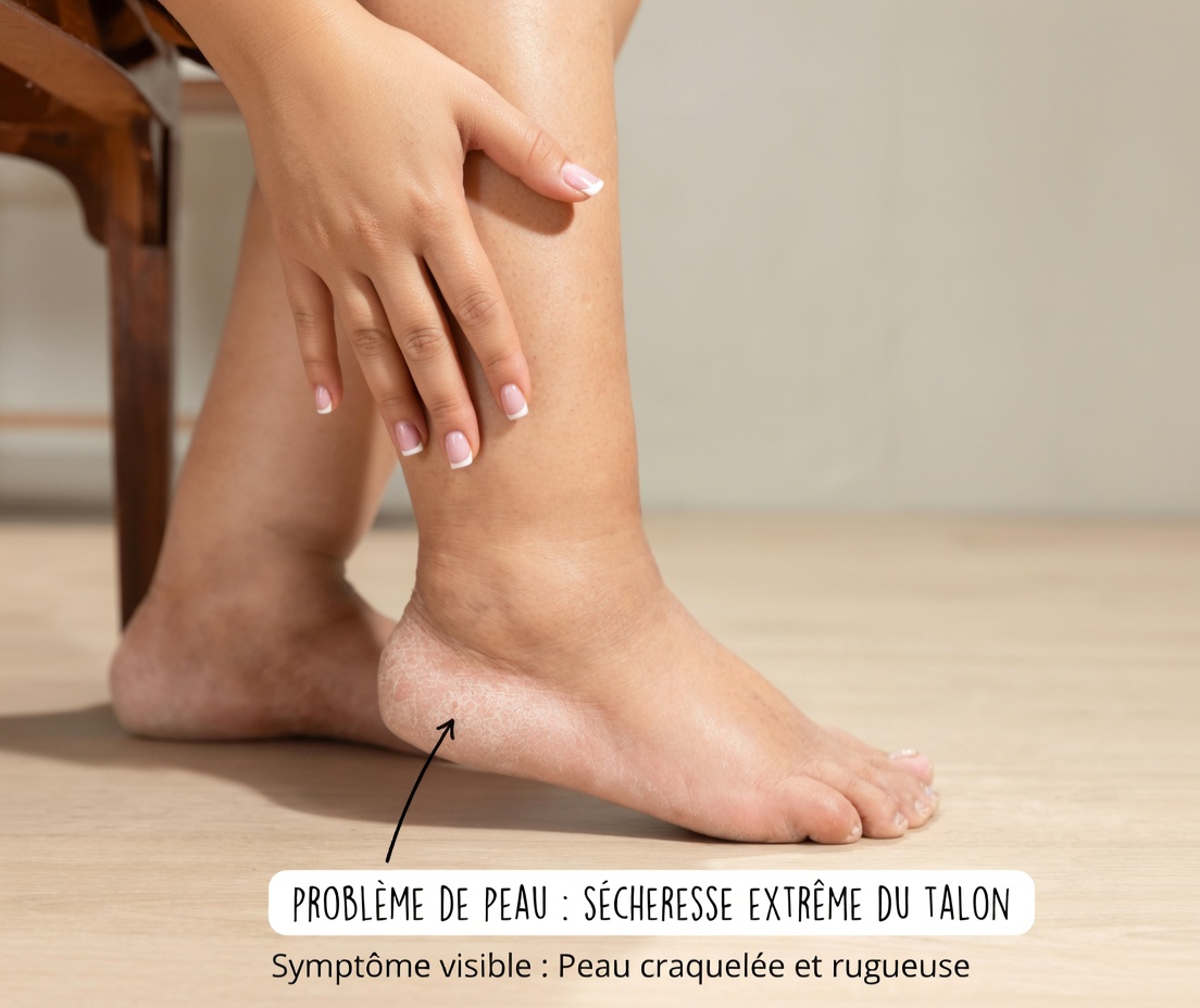 Découverte de 12 effets secondaires de l’amlodipine que les médecins soulignent rarement mais que les patients ressentent au quotidien