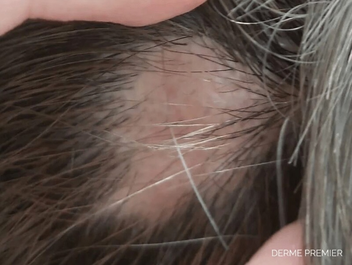 Voici 8 signes étranges que votre corps vous supplie de lui donner de la vitamine B12 et que la plupart des gens négligent complètement