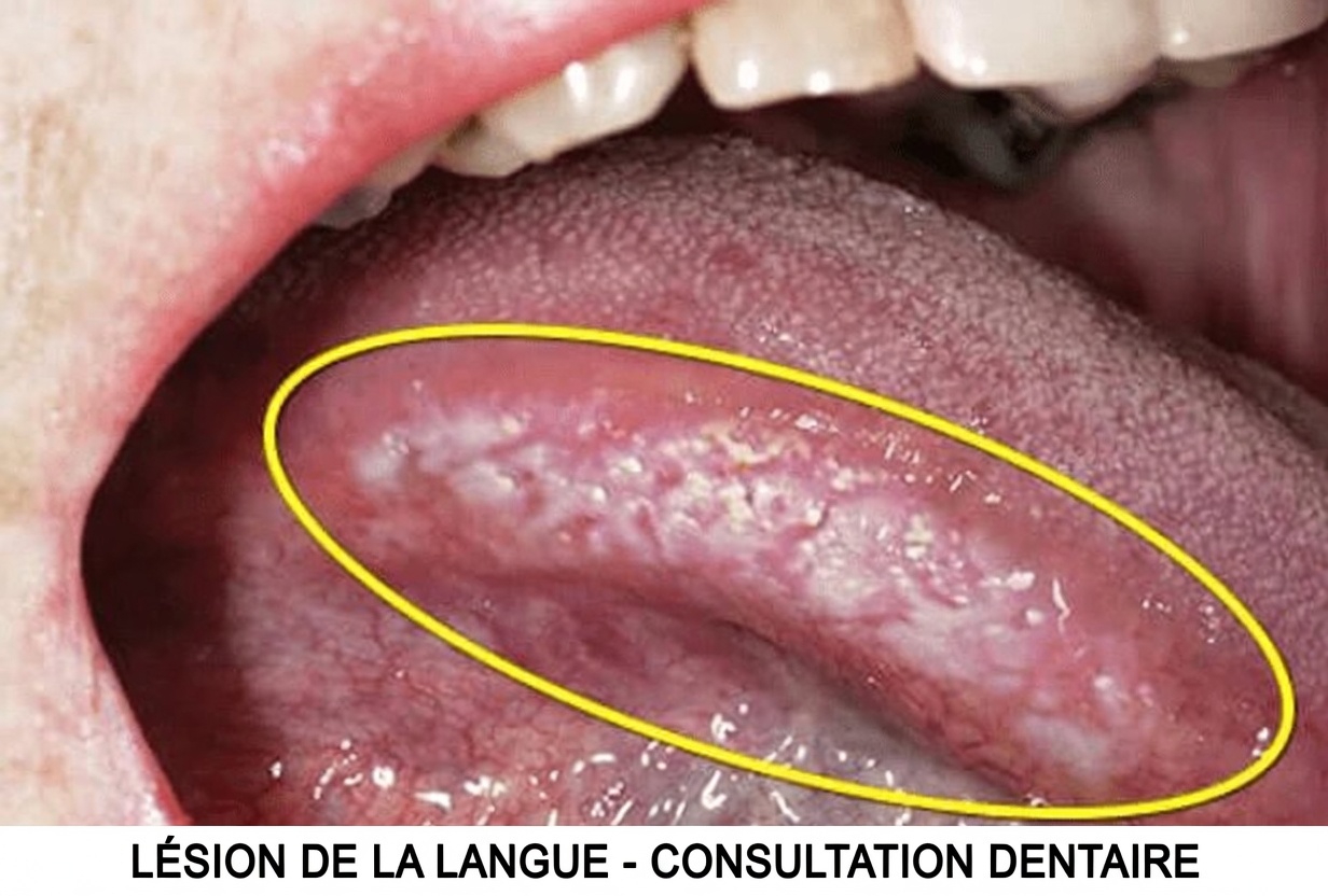 La réinitialisation de la langue en 10 secondes du Japon après 60 ans : une habitude discrète que votre système nerveux pourrait adorer