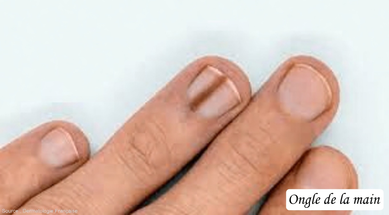 14 signes visibles du cancer que la plupart des femmes négligent, mais qu’elles devraient connaître