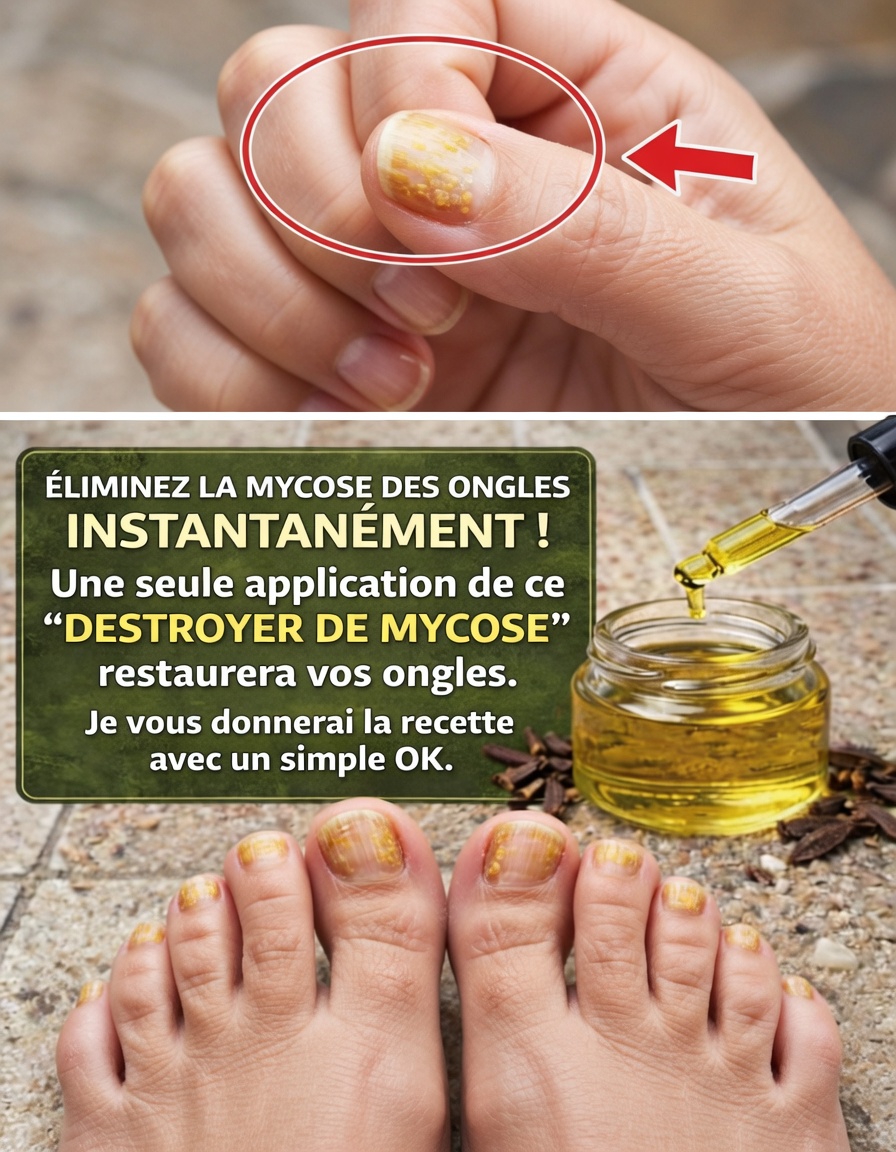 Découvrez pourquoi les clous de girofle attirent l’attention pour le soutien à la santé des ongles : recettes simples, bienfaits et habitudes quotidiennes expliqués
