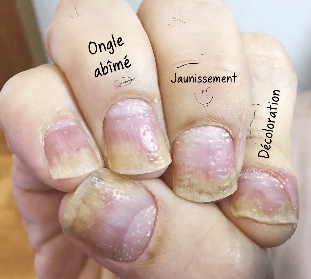 Découvrez pourquoi les clous de girofle attirent l’attention pour le soutien à la santé des ongles : recettes simples, bienfaits et habitudes quotidiennes expliqués