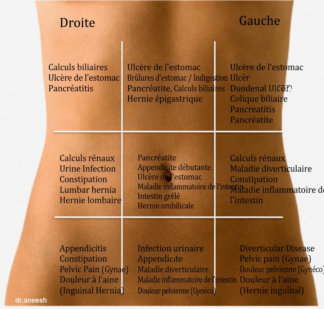 Explication des zones de projection des douleurs abdominales : votre guide complet pour comprendre la douleur dans différentes parties de l’abdomen