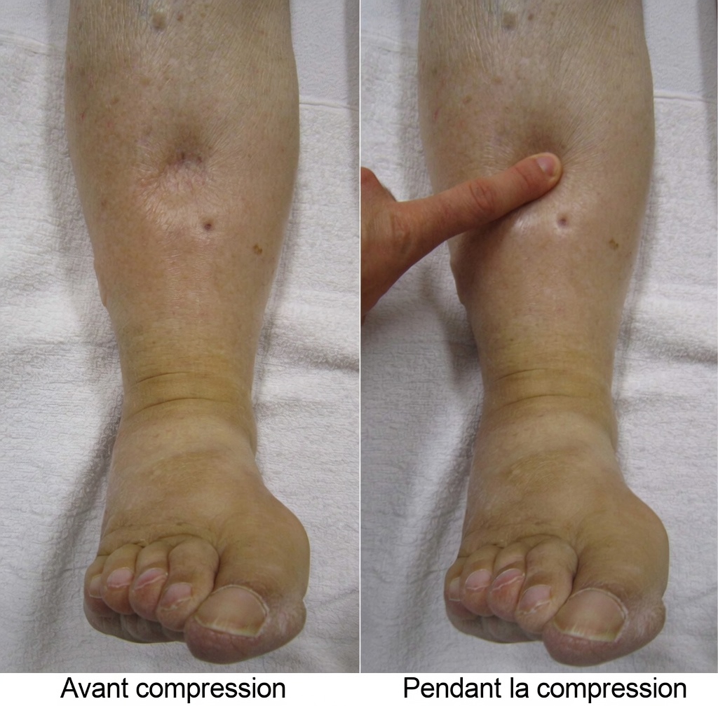 Découvrez 12 effets secondaires de l’amlodipine que vous devriez connaître et des conseils pratiques pour y faire face