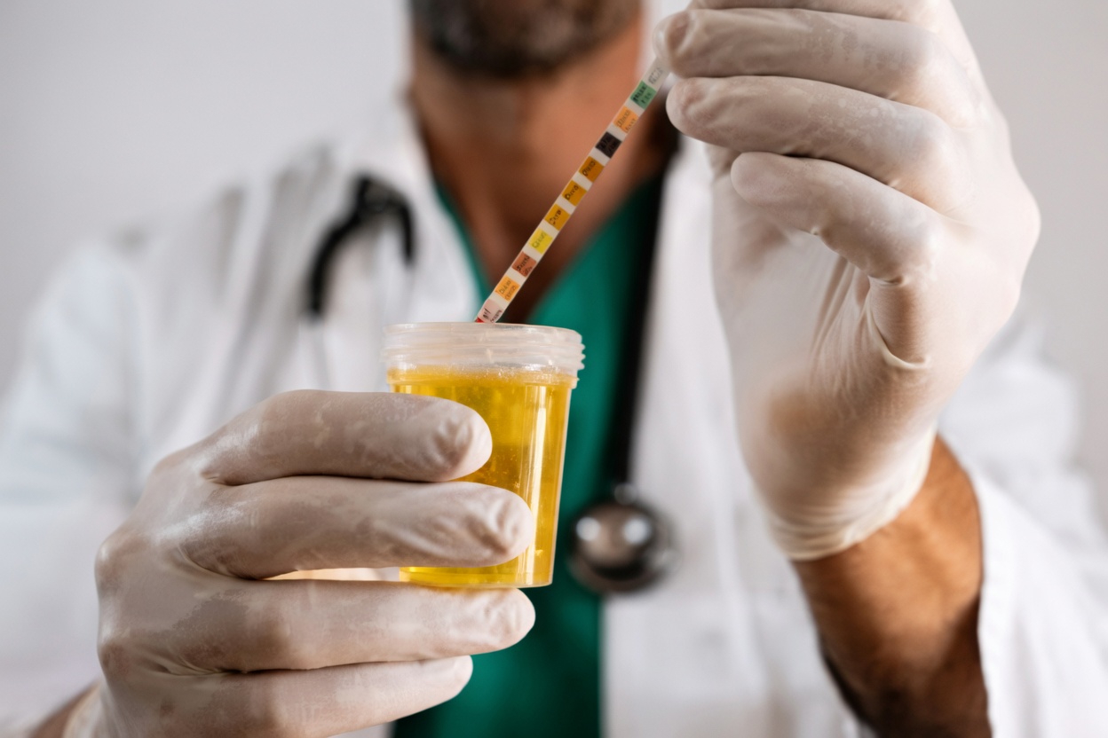 Des protéines s’échappent-elles dans vos urines ? 7 aliments curatifs puissants et stratégies qui peuvent soutenir vos reins dès aujourd’hui