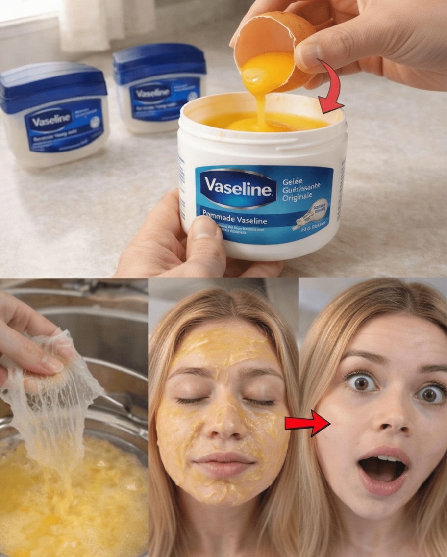 Plus aucune ride à 65 ans ! Le masque de nuit au jaune d’œuf et à la vaseline qui a tellement repulpé le visage de ma mère que ses amies ont cru qu’elle avait fait des injections de comblement