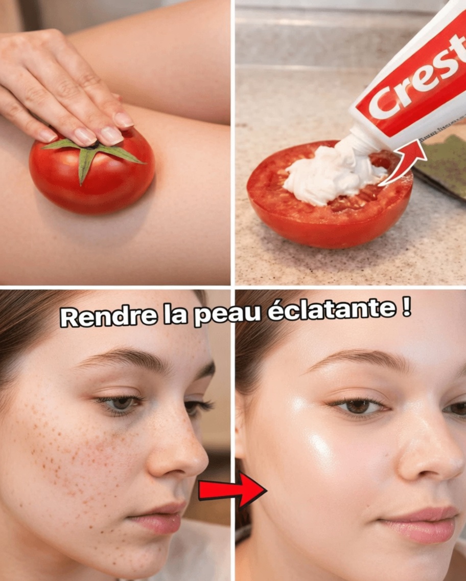 Découvrez le masque visage viral au dentifrice et à la tomate que beaucoup essaient pour l’apparence de pores plus resserrés, de taches brunes estompées, d’une peau plus lumineuse et d’une réduction plus douce des poils du visage