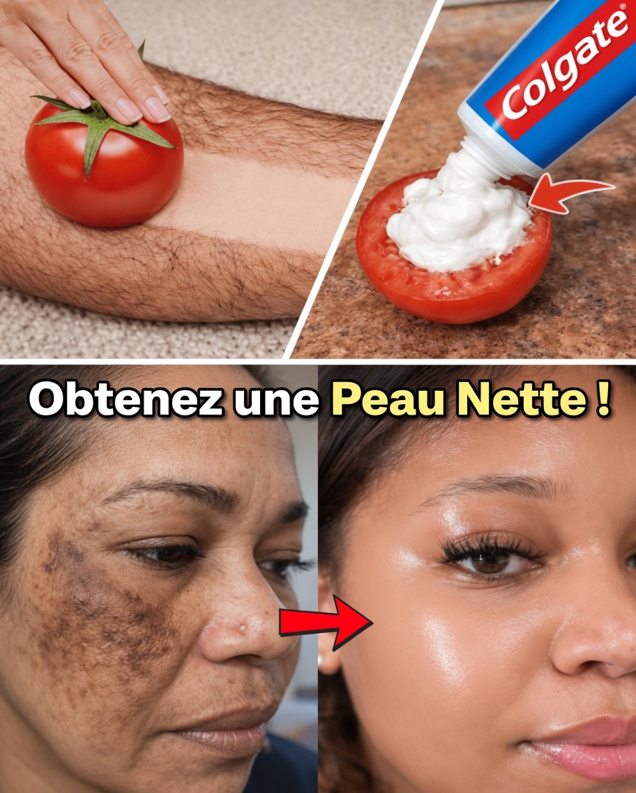 Découvrez le masque visage viral au dentifrice et à la tomate que beaucoup essaient pour l’apparence de pores plus resserrés, de taches brunes estompées, d’une peau plus lumineuse et d’une réduction plus douce des poils du visage