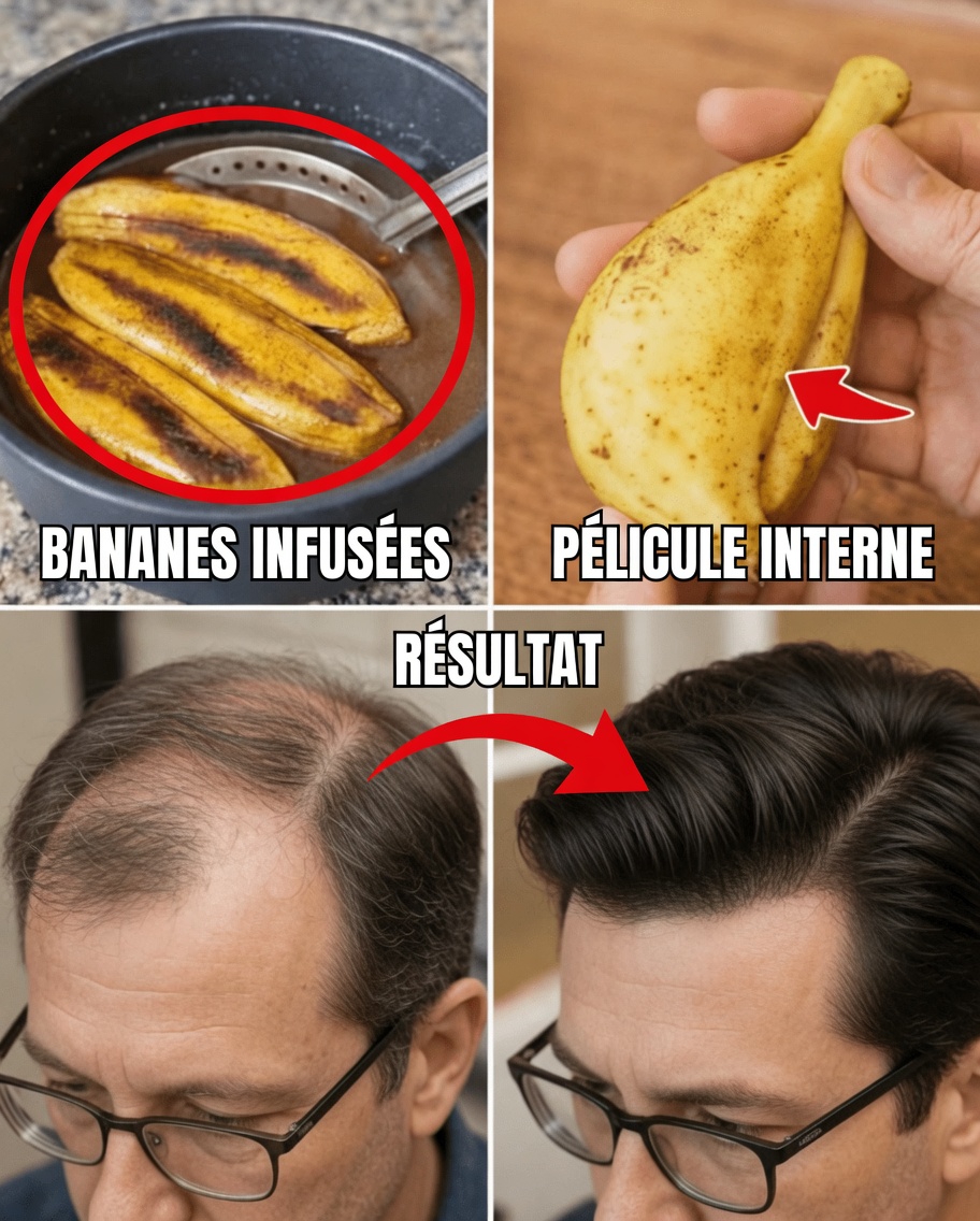 Découvrez comment les pelures de banane peuvent favoriser des cheveux plus sains et plus forts : 7 méthodes naturelles à essayer