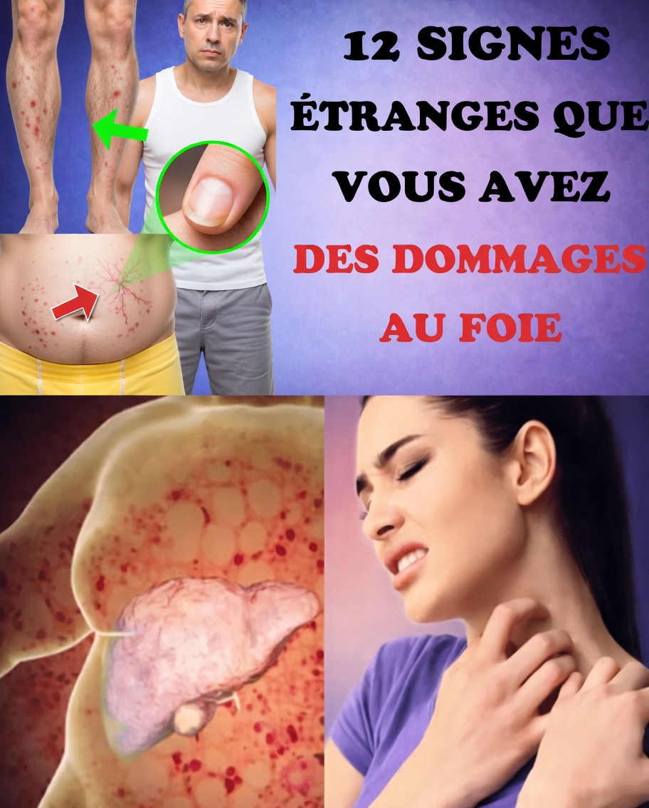 12 signes d’alerte inhabituels indiquant que votre foie pourrait être en difficulté (et pourquoi vous ne devriez pas les ignorer)