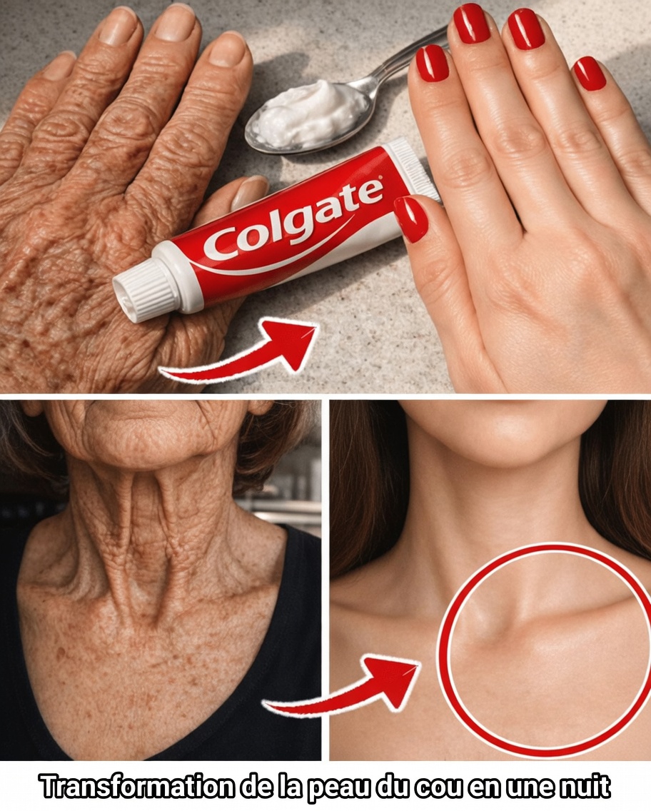 Pourquoi le dentifrice et le bicarbonate de soude contre les rides et les taches brunes ne sont pas le meilleur choix, et quelles habitudes douces pourraient aider à la place