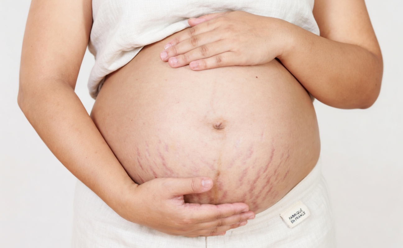Comment prendre soin de votre peau pendant la grossesse et les changements de la vie : des habitudes simples qui aident à minimiser l’apparence des vergetures