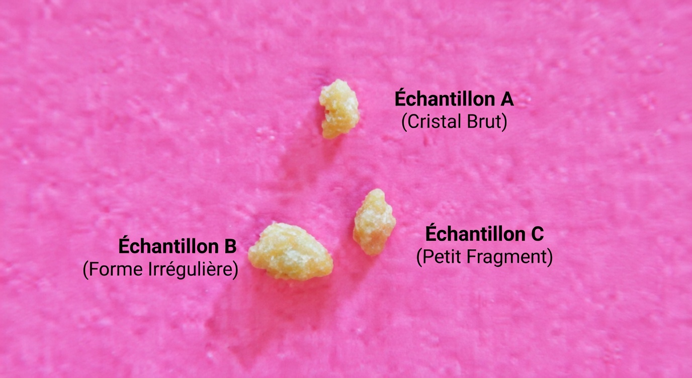 Que sont ces pierres blanches dans votre gorge qui provoquent une mauvaise haleine et de l’inconfort ?