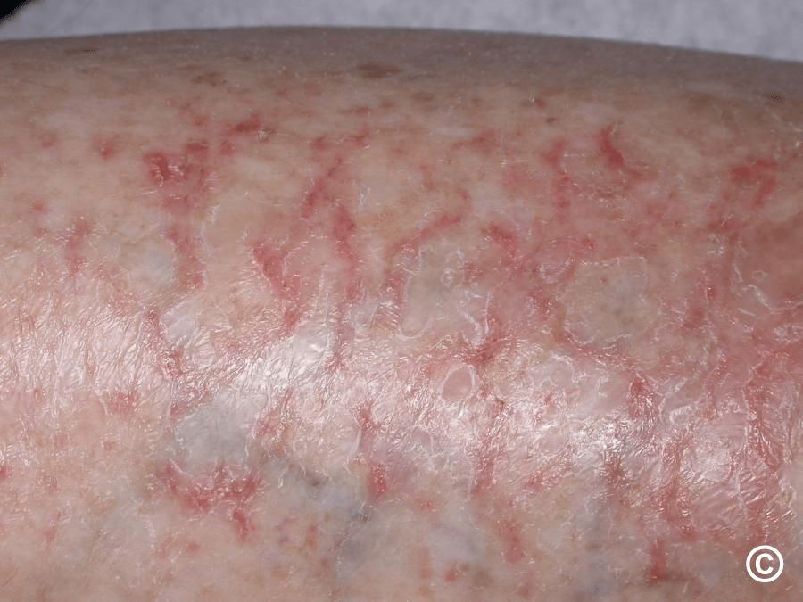 Découvrez ce que vos pieds révèlent sur la santé de votre foie : 12 signes courants à surveiller