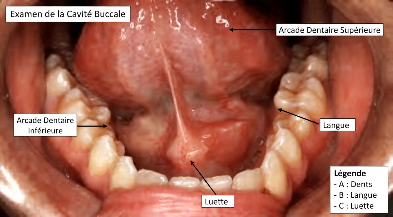 Pourquoi vous vous réveillez toujours avec la bouche sèche — et ce que cela pourrait vous indiquer
