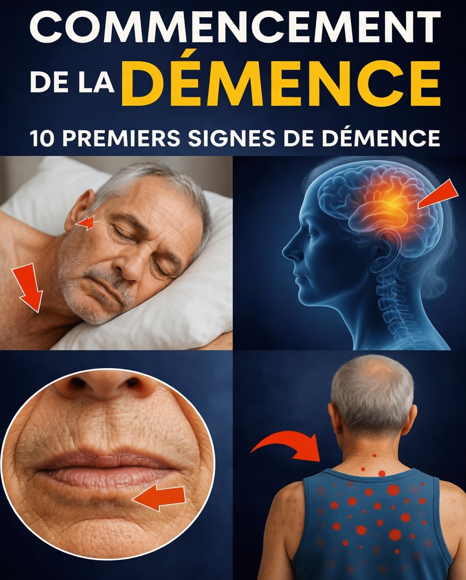 10 signes précoces de la démence à reconnaître et des habitudes simples pour soutenir la santé de votre cerveau