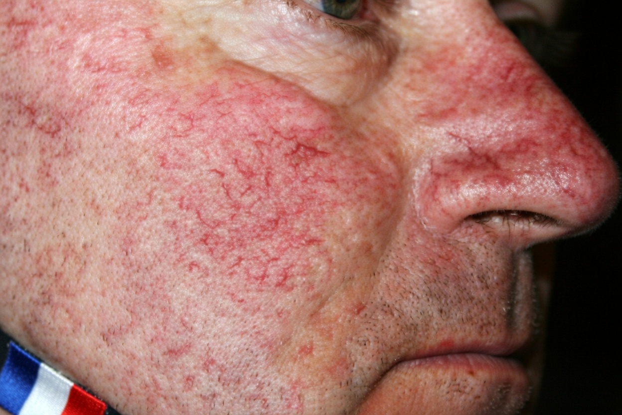 Votre foie envoie-t-il des signaux d’alerte ? 7 indicateurs à ne pas ignorer (et ce qui aide vraiment)