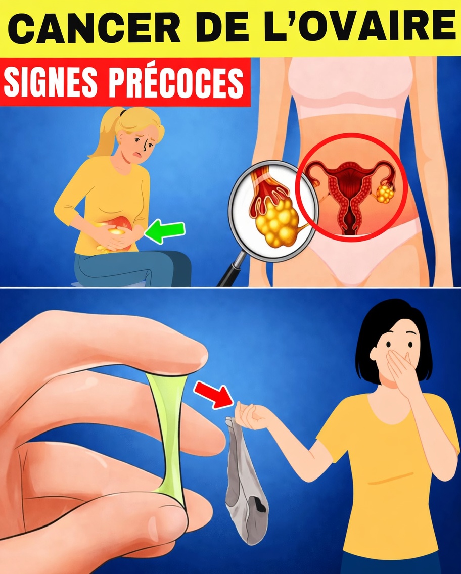 8 signes silencieux du cancer de l’ovaire que chaque femme doit connaître (et pourquoi une détection précoce peut sauver des vies)
