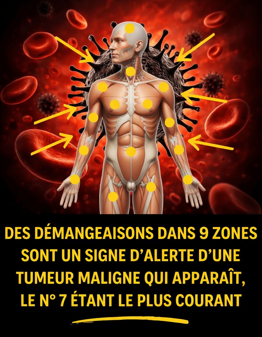Démangeaisons dans 9 zones : un signe avant-coureur de tumeurs malignes, la numéro 7 est la plus fréquente