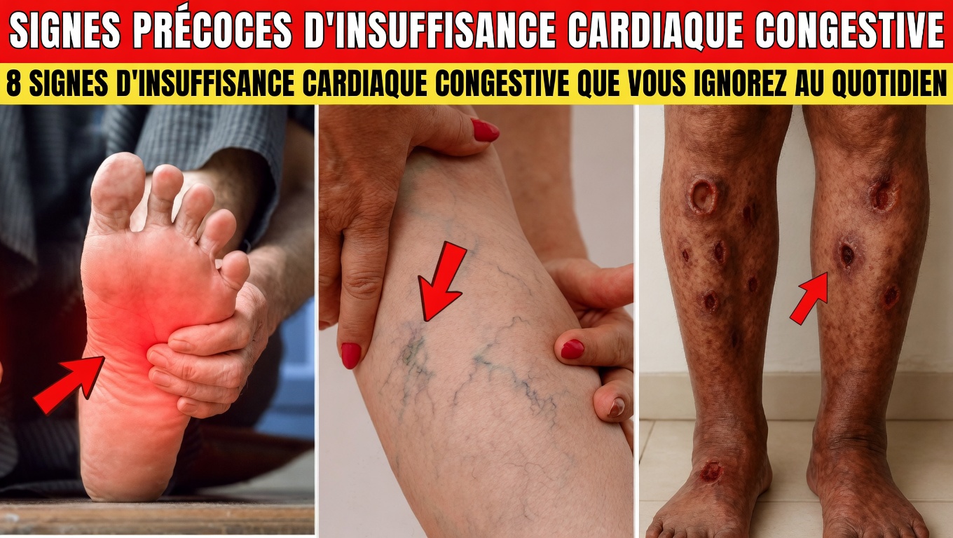 12 symptômes importants de l’insuffisance cardiaque congestive qui peuvent apparaître dans vos jambes et vos pieds