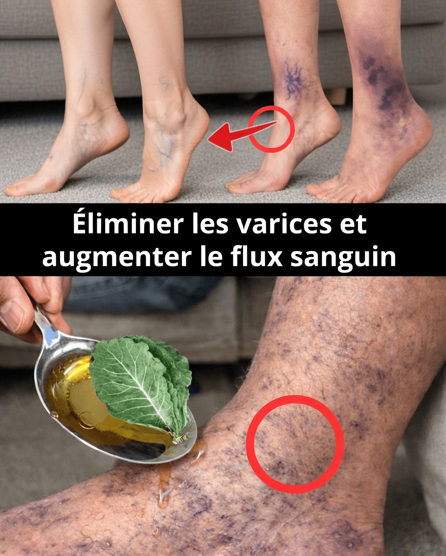 10 habitudes naturelles du quotidien qui peuvent aider à stimuler la circulation sanguine et à favoriser des veines des jambes plus saines
