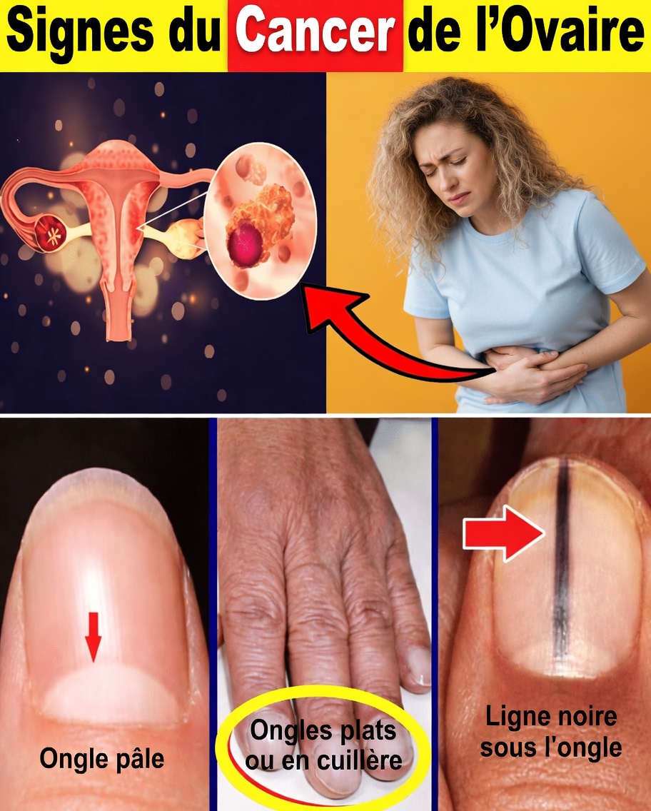 Femmes : n’ignorez pas ces 14 signaux cachés du cancer qui pourraient sauver des vies