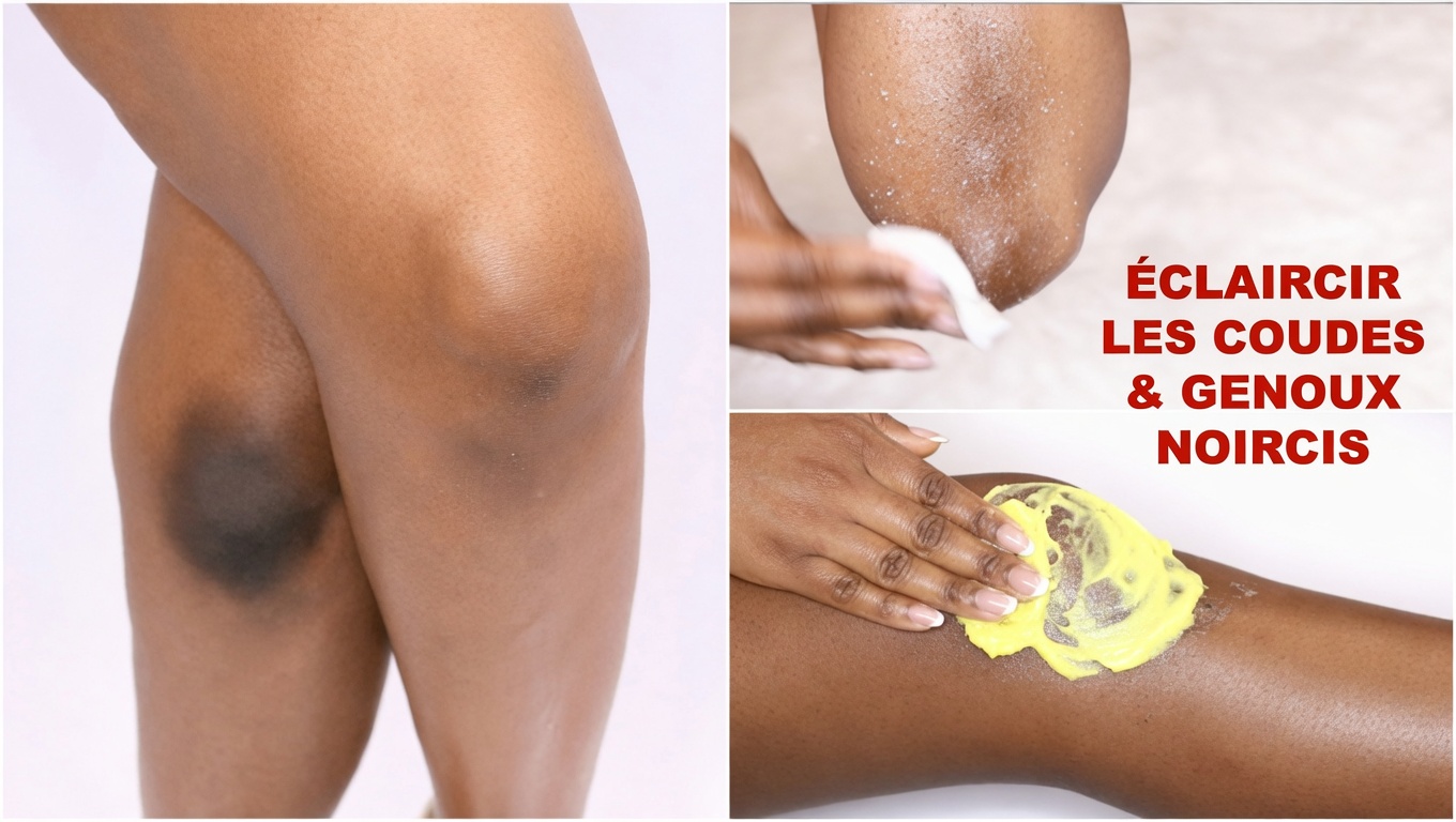 Citron sur les coudes, les genoux et les aisselles : l’astuce douce de 5 minutes qui a effacé 10 ans de taches sombres pour des milliers de personnes