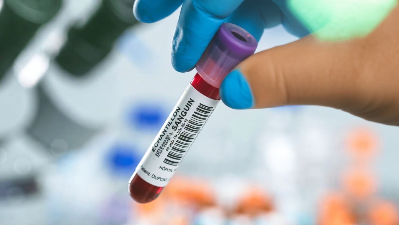 Des médecins révèlent le seul groupe sanguin présentant le plus faible risque de cancer selon des études récentes