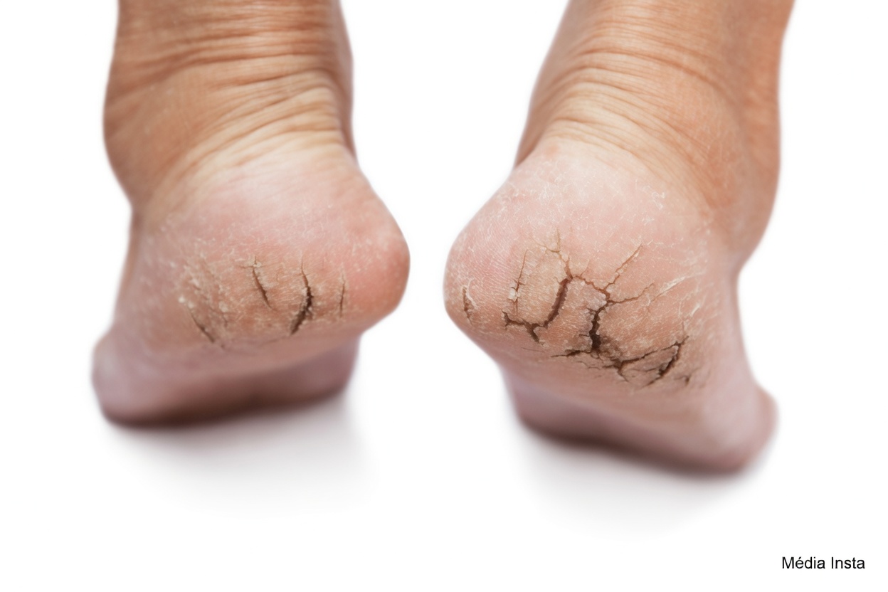 Découvrez 8 changements imperceptibles dans votre corps qui pourraient avertir de problèmes de santé