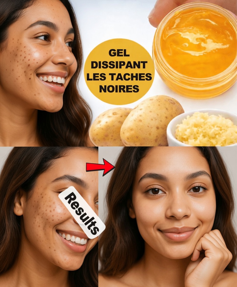 Dévoilez le secret de la cuisine : comment les pommes de terre et le gingembre peuvent favoriser un teint plus lumineux et plus uniforme