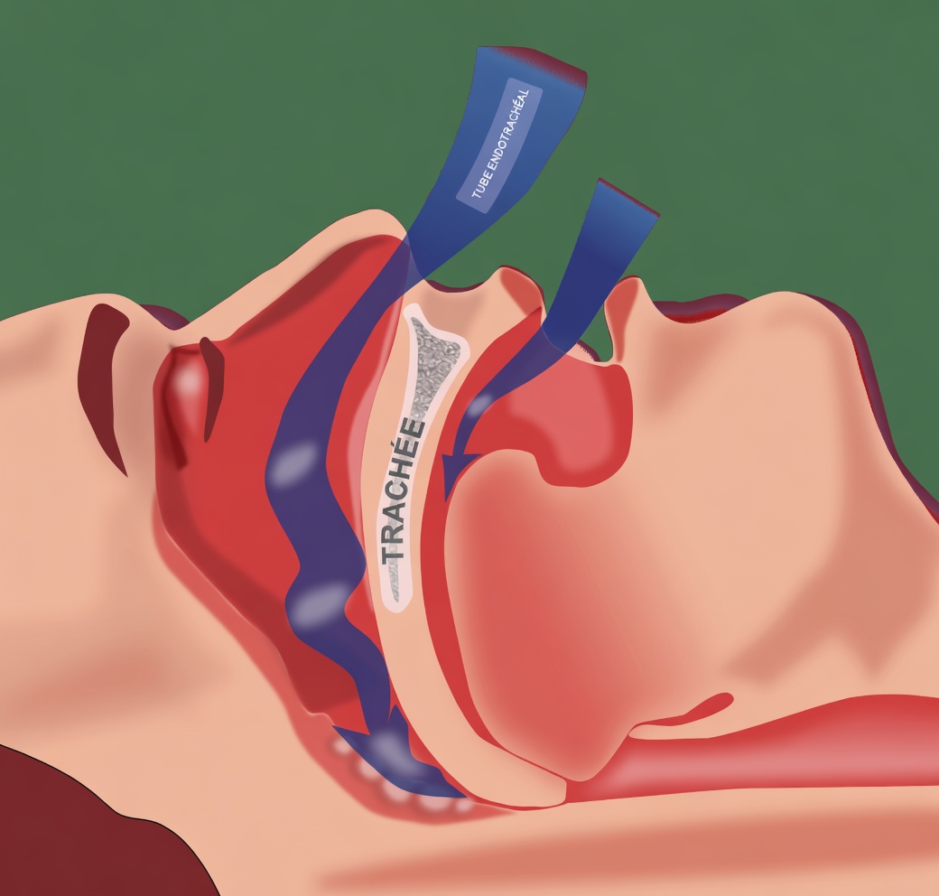 Si vous bavez en dormant, vous devriez vous faire dépister pour ces 8 affections