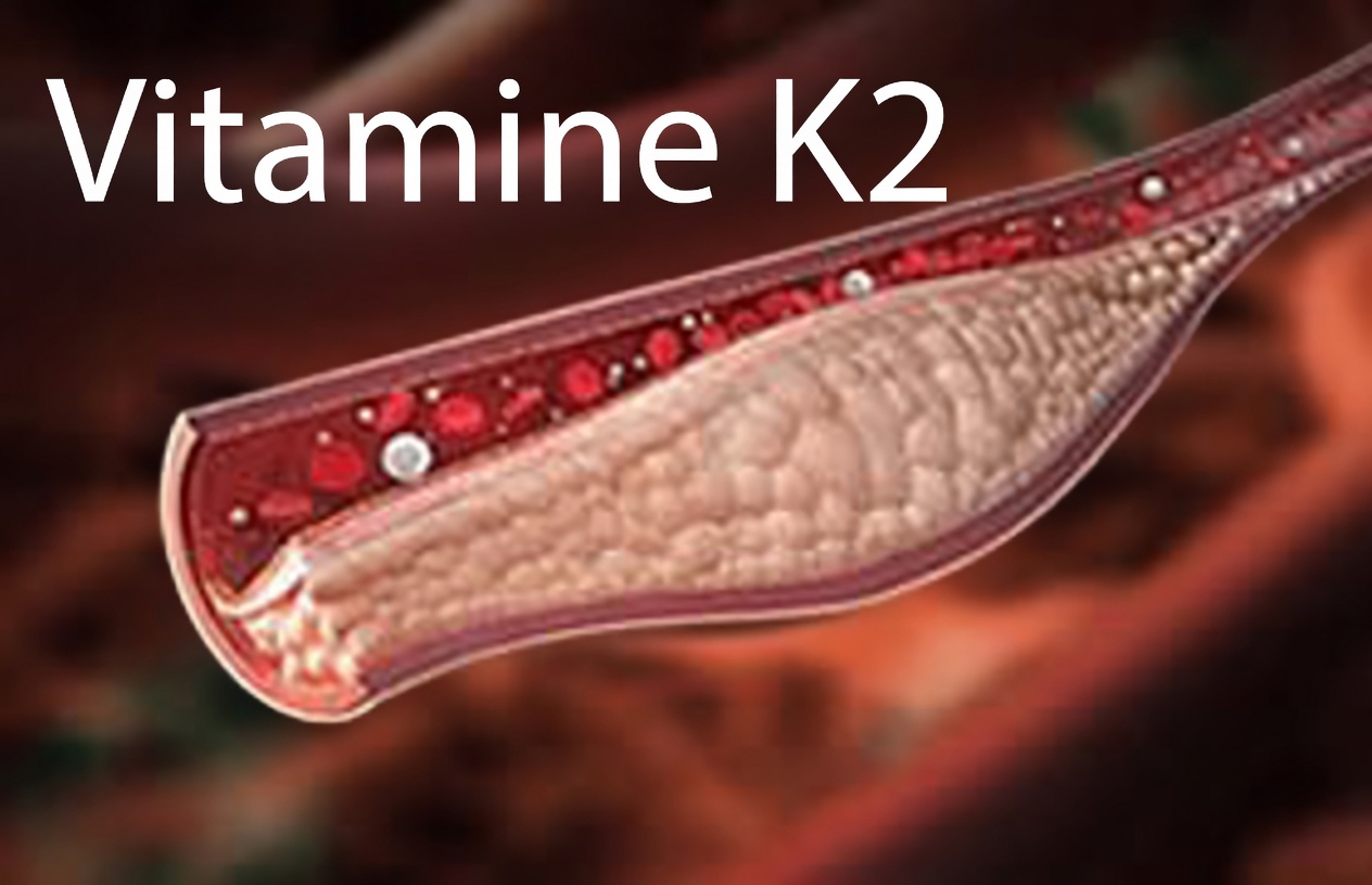 Une vitamine empêche l'accumulation de calcium dans les artères et le cœur