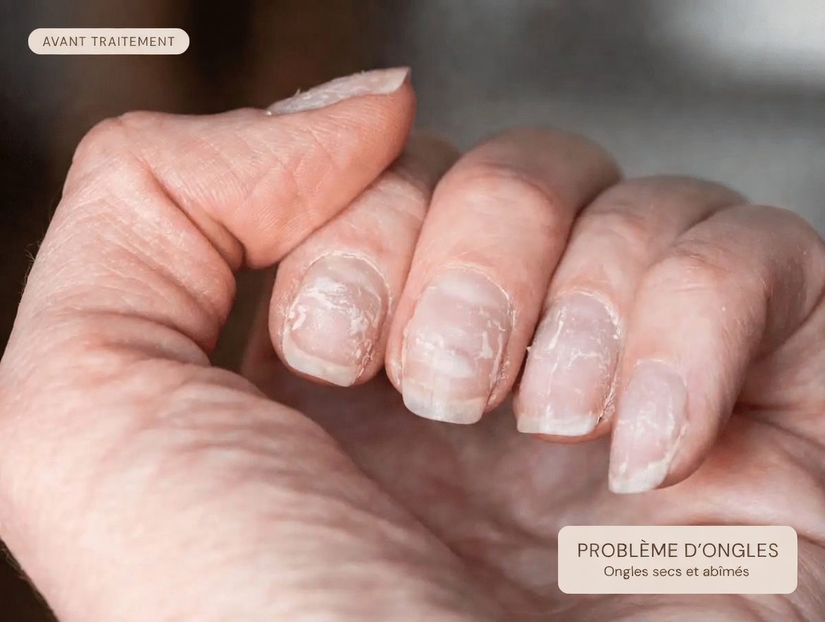 La menace silencieuse tapie dans votre foie : 8 signes avant-coureurs de la stéatose hépatique à reconnaître