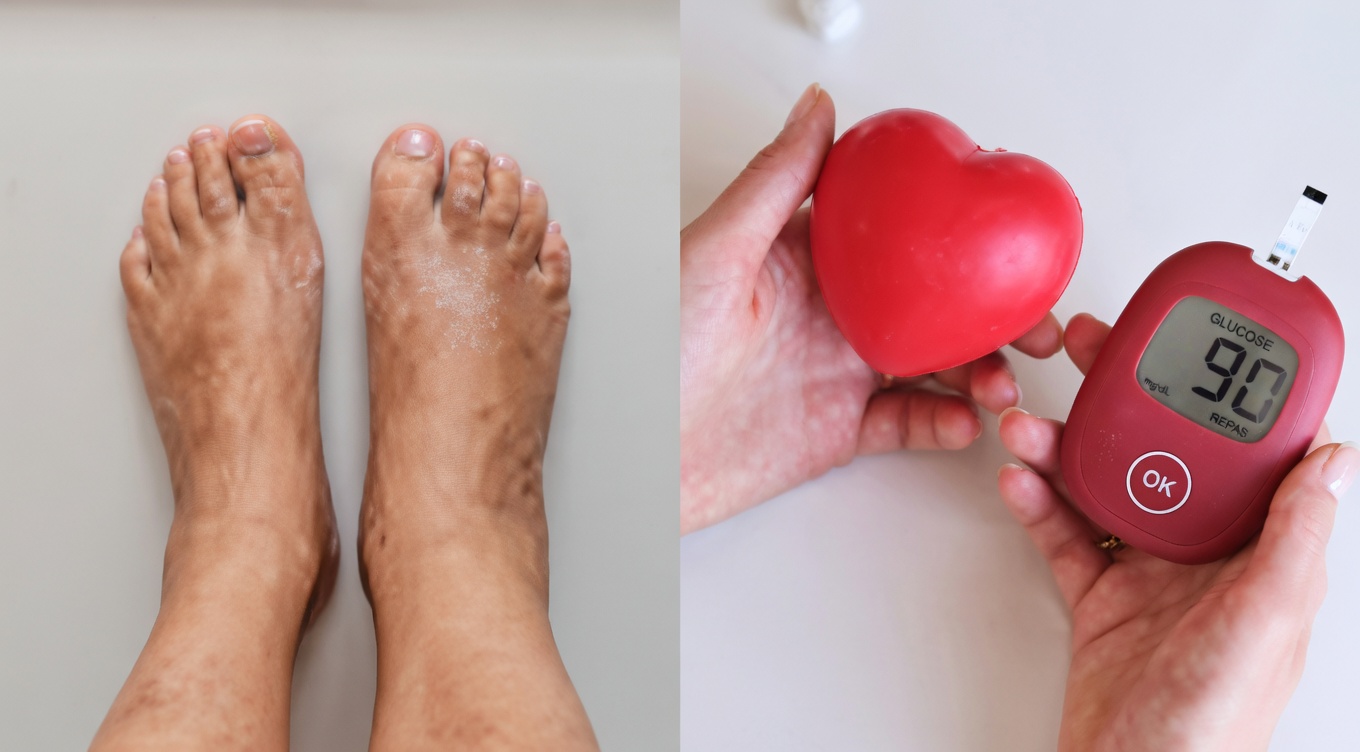 Seniors, vos jambes murmurent-elles des avertissements que vous ne pouvez pas ignorer ? 4 vitamines qui peuvent soutenir une circulation saine dans les jambes