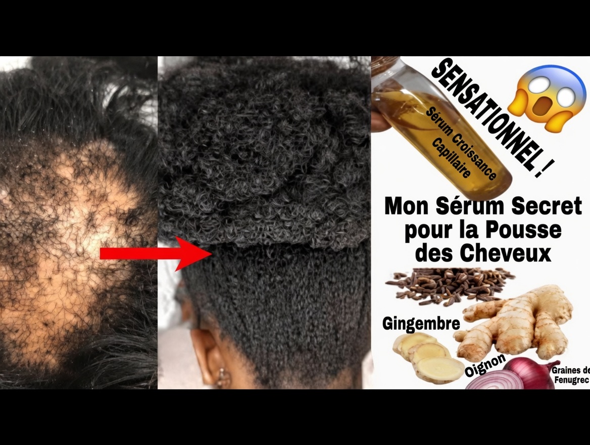 Clous de girofle, romarin et gingembre : la lotion capillaire simple à 3 ingrédients qui étonne tout le monde (mieux que l’aloe vera ?)