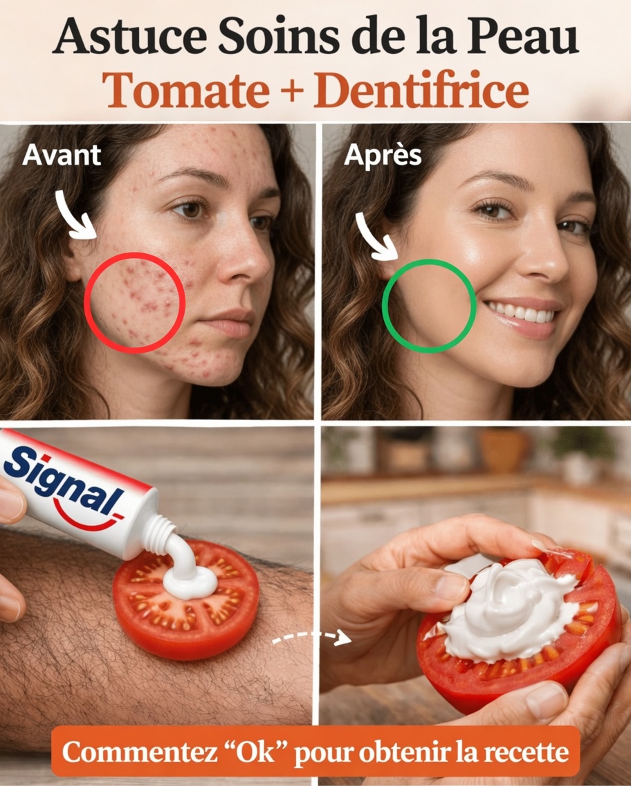 Obtenez une peau parfaite naturellement : le masque visage au dentifrice et à la tomate qui cible les pores dilatés, les taches sombres et les poils indésirables
